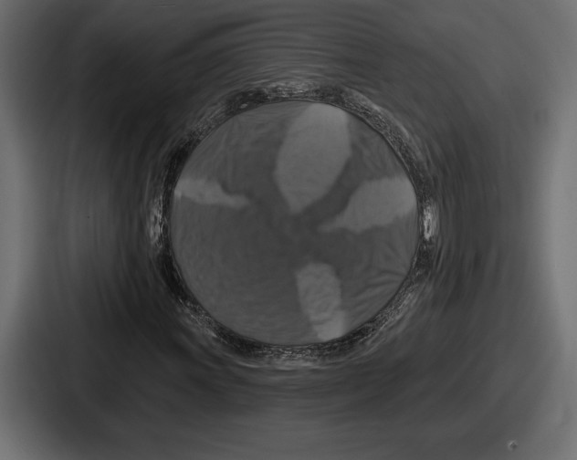 X0000086731011200705111610