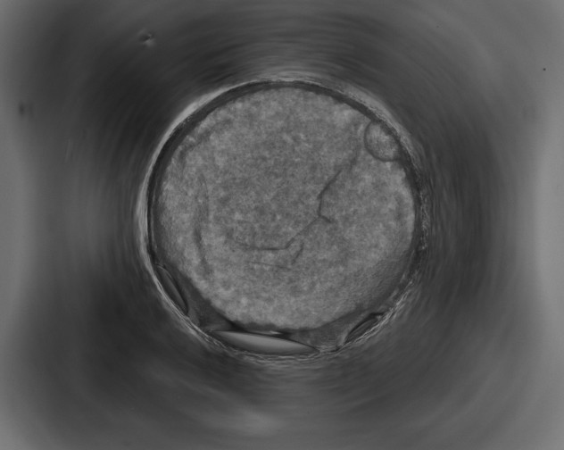X0000086731032200705111611