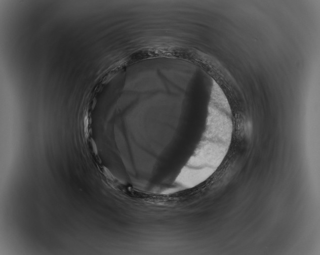 X0000086731060200705111610