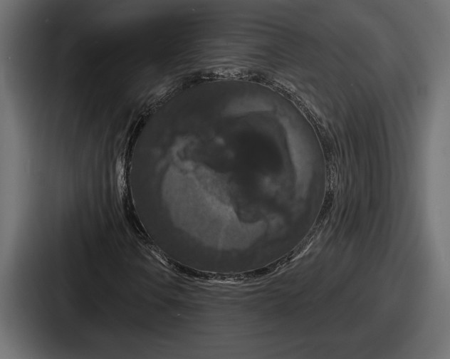 X0000086731106200705111609