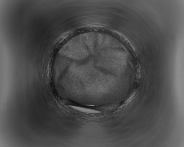 X0000086731110200705111609