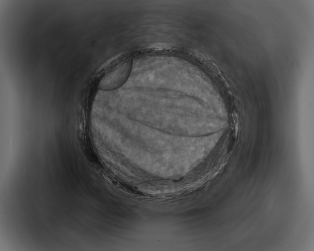 X0000086731158200705111609
