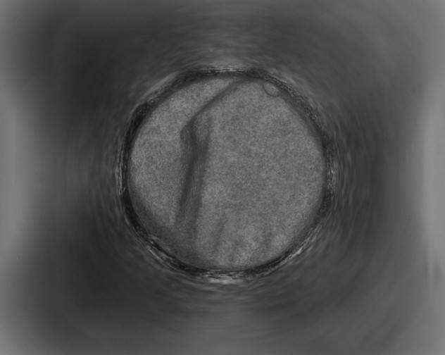 X0000086731205200705111608