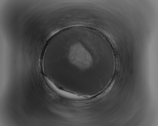 X0000086731497200705111604