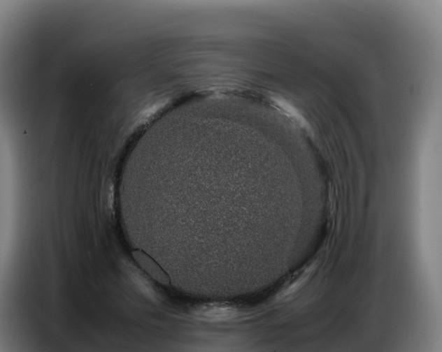 X0000086740589200704201707