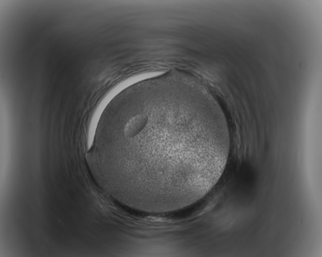 X0000086740699200704201706