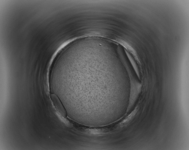 X0000086740792200704201705