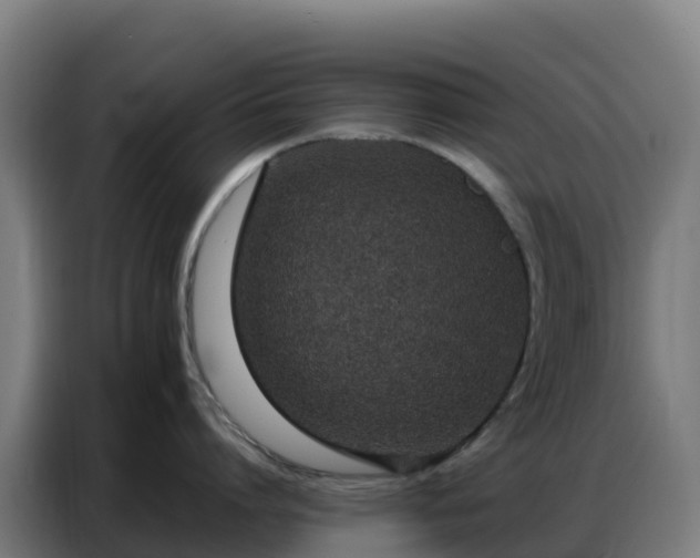 X0000086740864200704201704