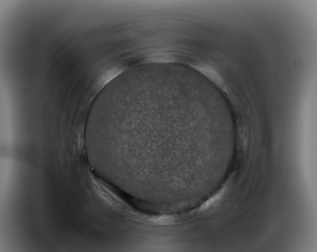 X0000086740889200704201703