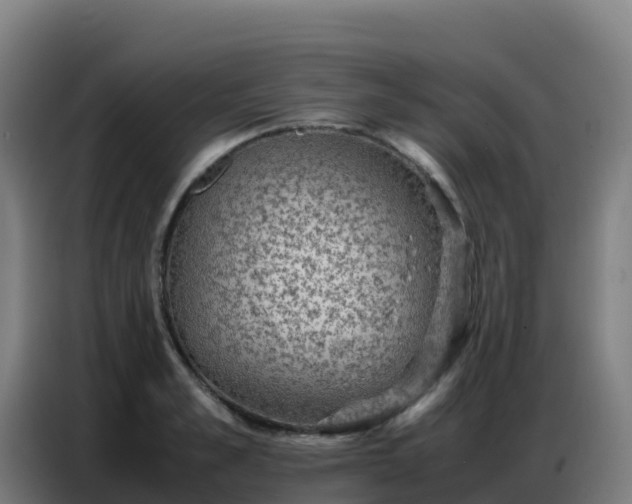 X0000086740989200704201702