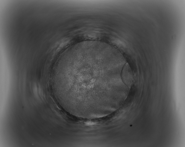 X0000086741009200704201701