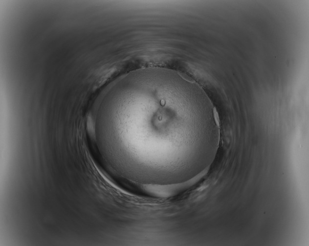 X0000086741010200704201701