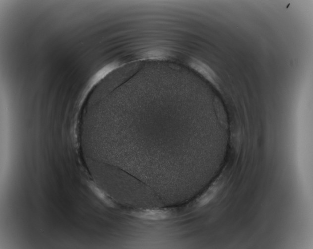 X0000086741026200704201701