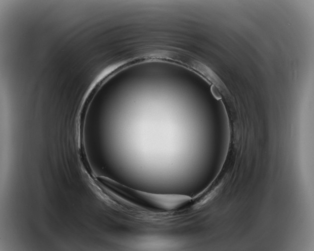 X0000086741036200704201702
