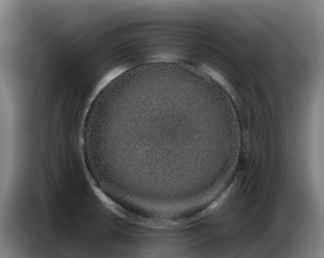 X0000086741042200704201702