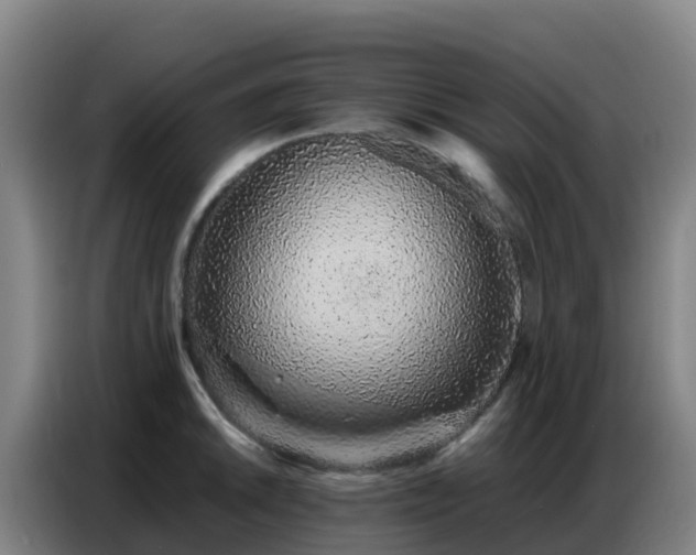 X0000086741046200704201702