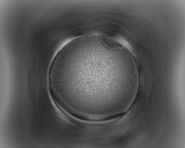 X0000086741047200704201702