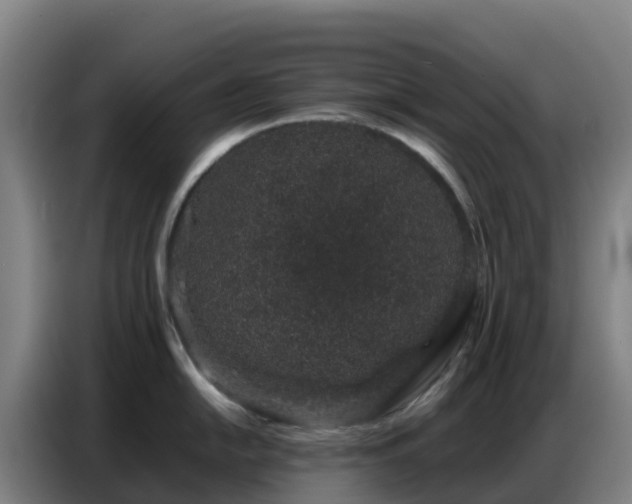 X0000086741054200704201702