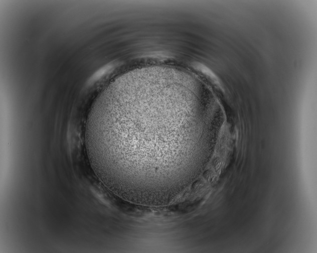 X0000086741064200704201701