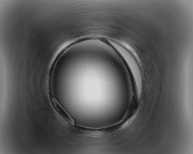 X0000086741085200704201701