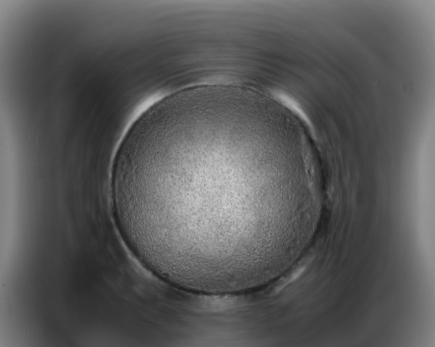 X0000086741087200704201701