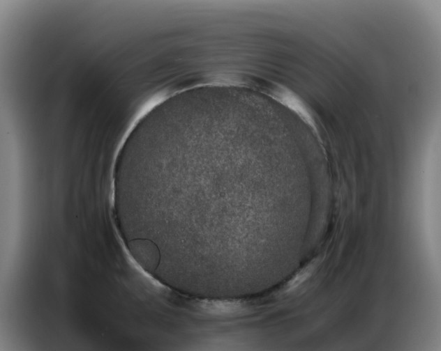 X0000086741095200704201701