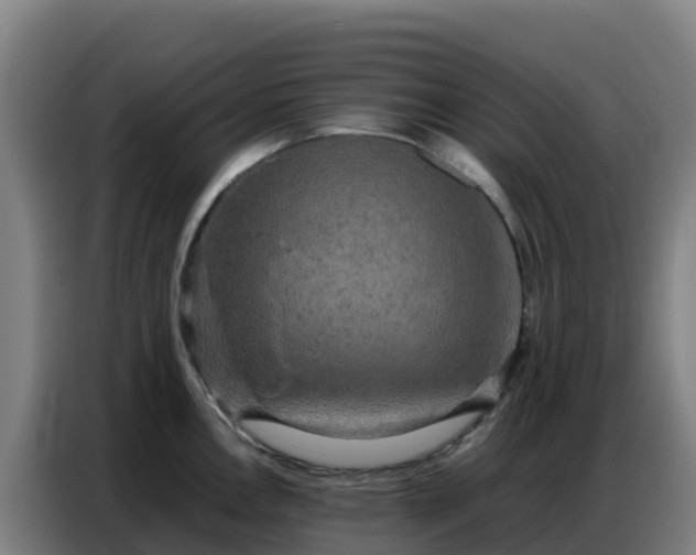 X0000086741146200704201701
