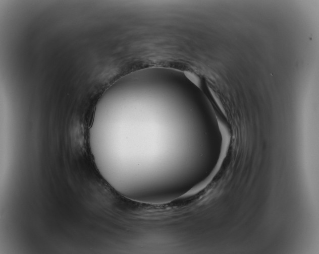 X0000086741156200704201700