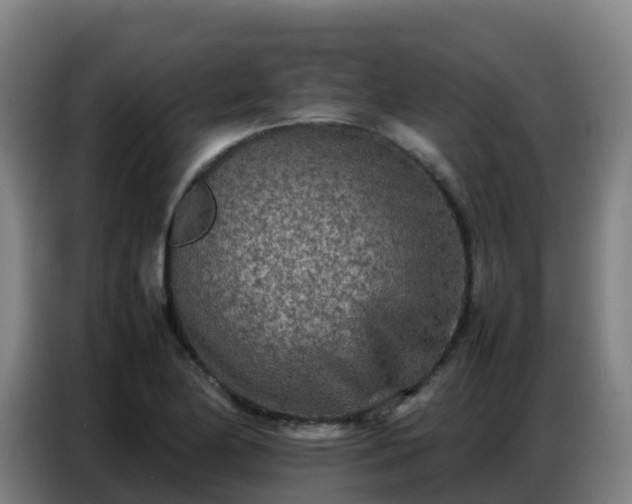 X0000086741174200704201700