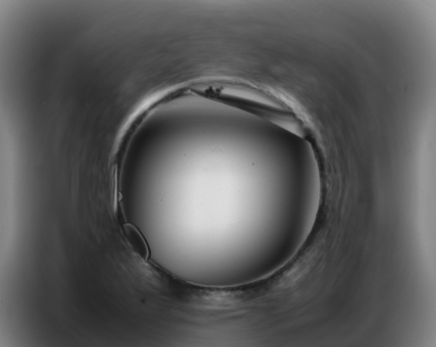 X0000086741175200704201700