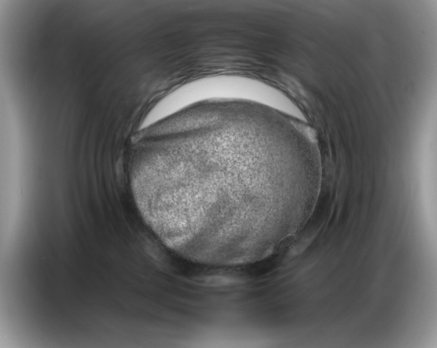 X0000086740377200704271655