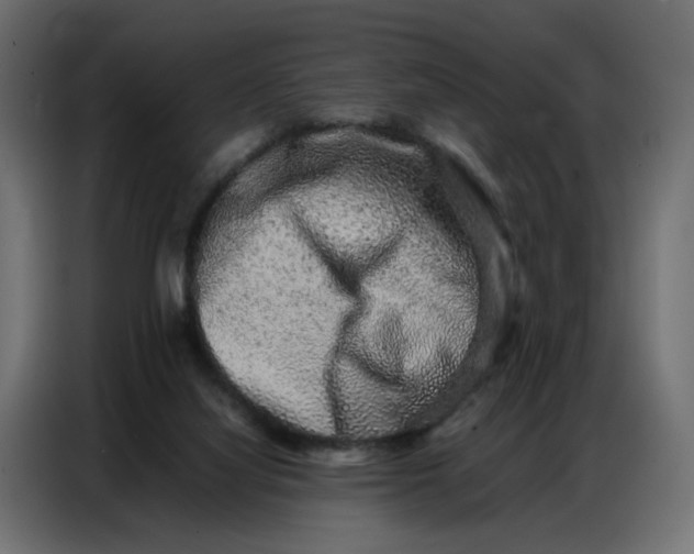 X0000086740068200705041416