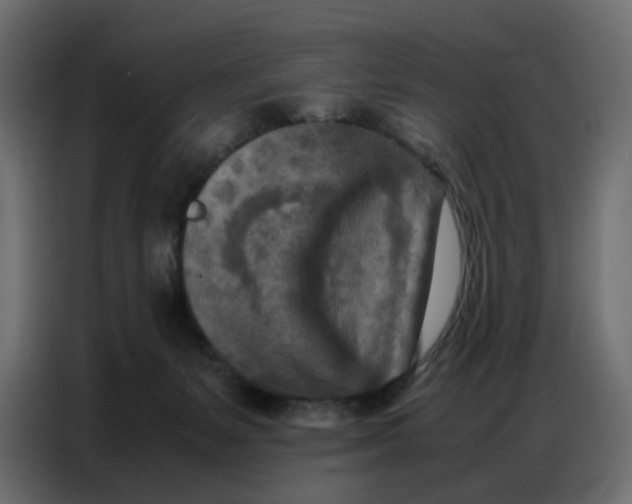 X0000086740127200705041415