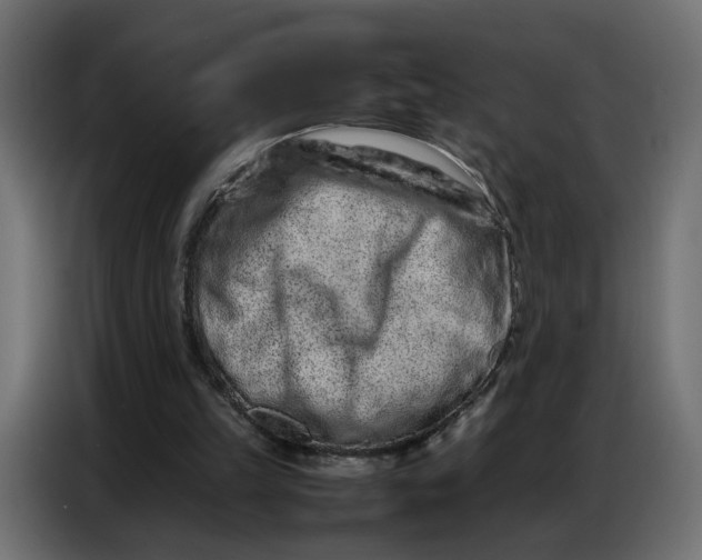 X0000086740149200705041414