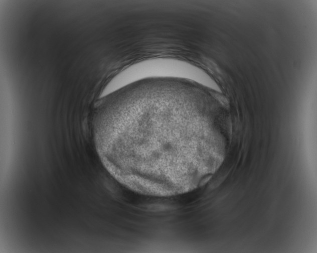 X0000086740377200705041412