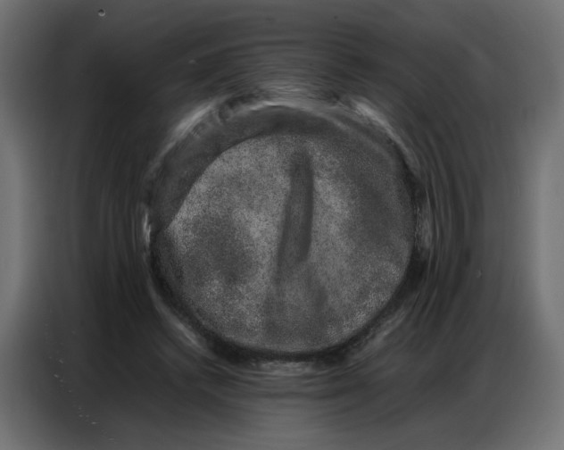 X0000086740448200705041411