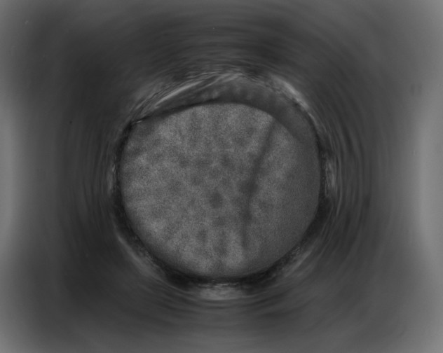 X0000086740451200705041411