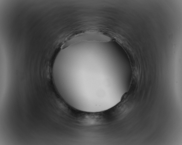 X0000086740470200705041411