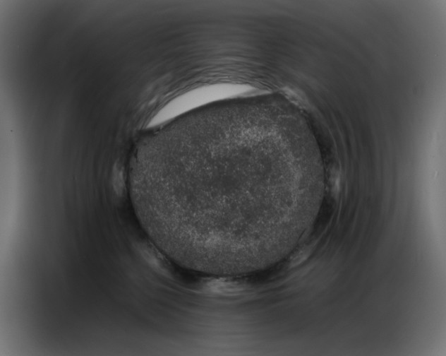 X0000086740568200705041410