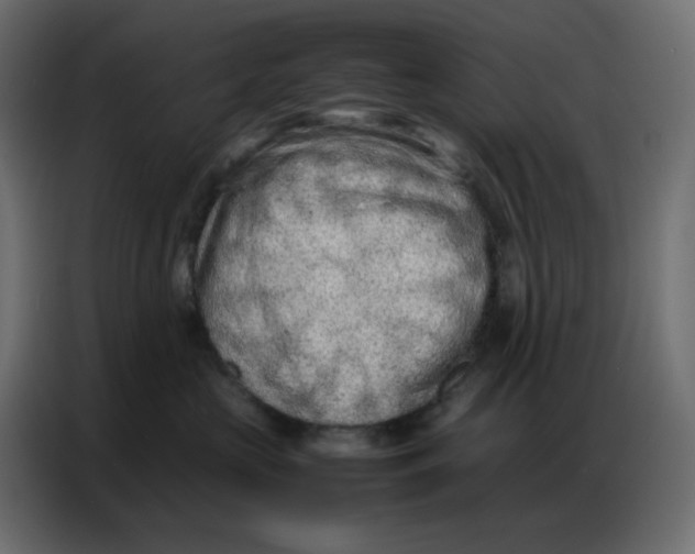 X0000086740573200705041410