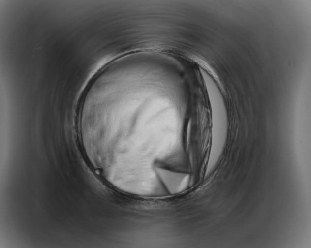 X0000086741091200705041403