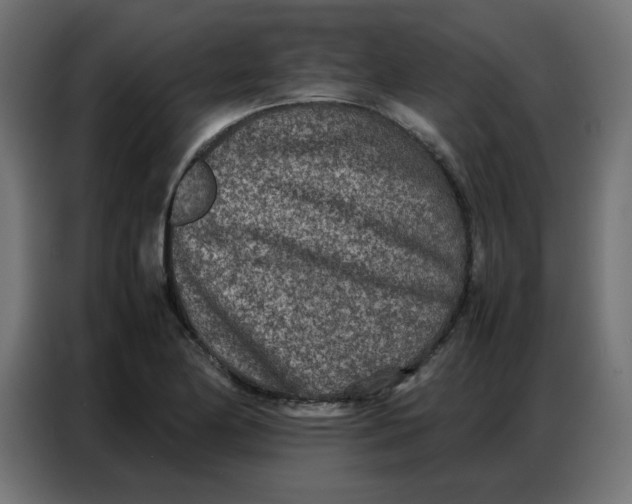 X0000086741174200705041401