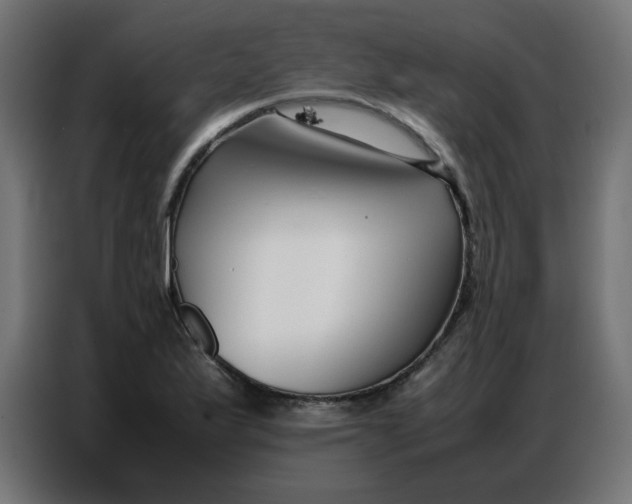 X0000086741175200705041401