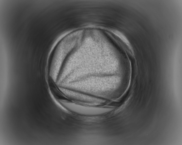 X0000086741247200705041401