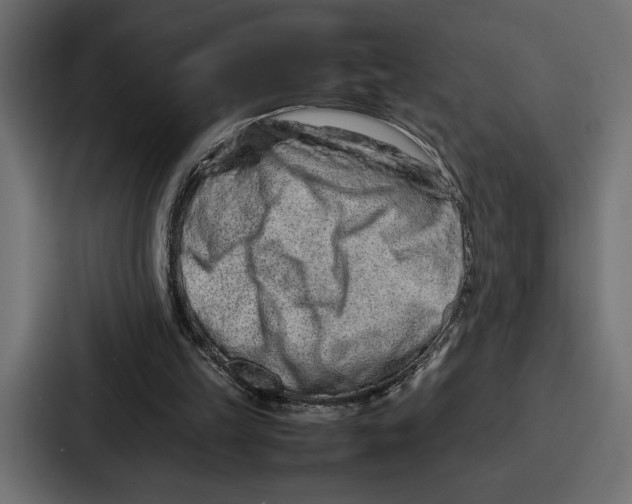 X0000086740149200705111642