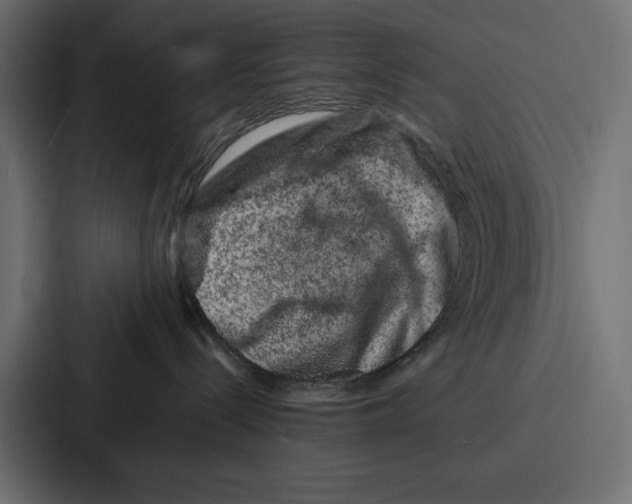X0000086740288200705111641