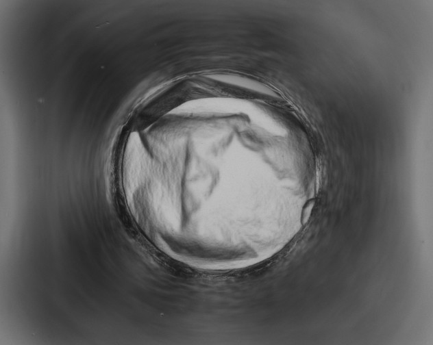 X0000086740339200705111639