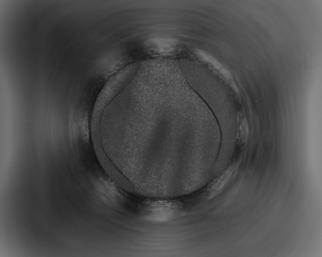 X0000086740562200705111637