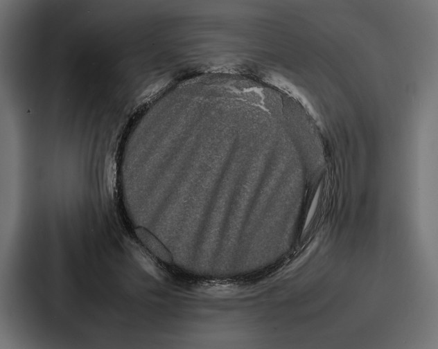 X0000086740589200705111636
