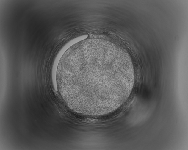 X0000086740699200705111635